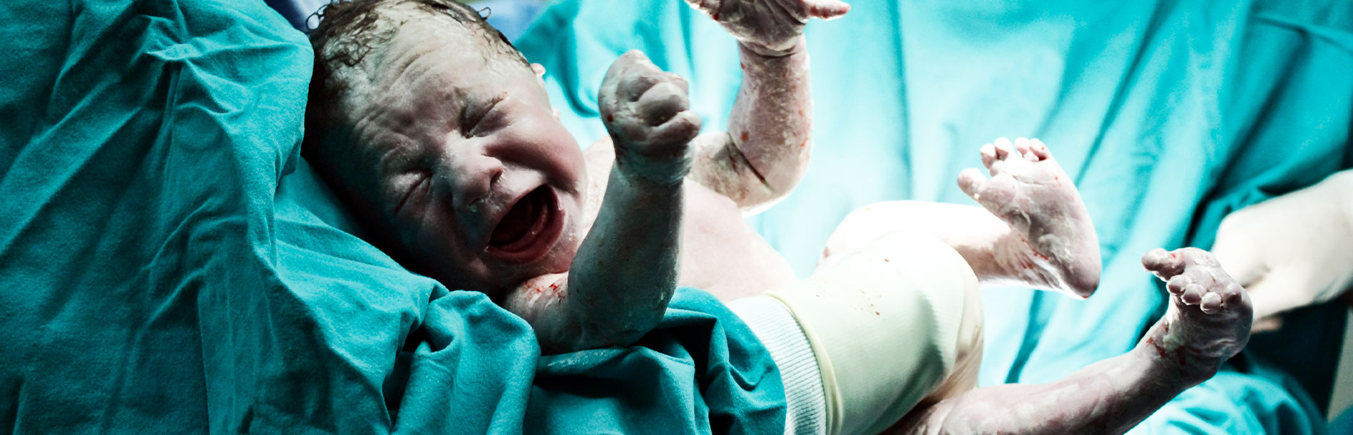 Vérnix caseoso: detalhe importante nas primeiras 24 horas do recém-nascido